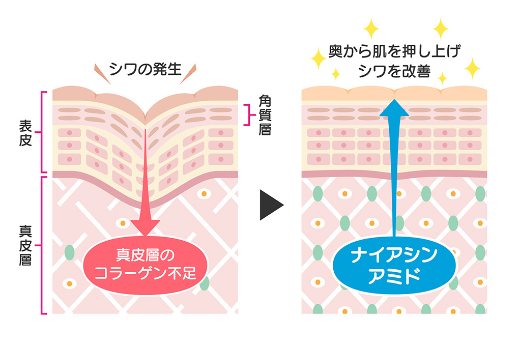 シワ改善の秘密