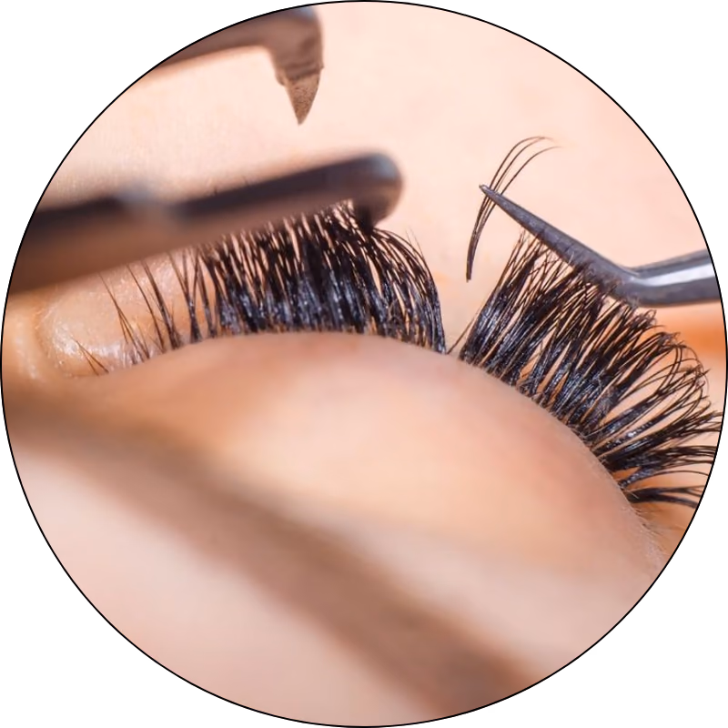 フィルラッシュを装着する施術の様子