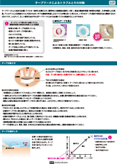 テープワークによるトラブルとその対策