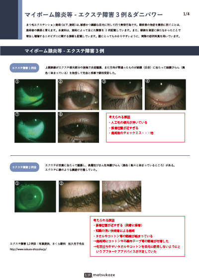 エクステ障害レポートまとめ