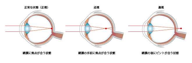 焦点の図